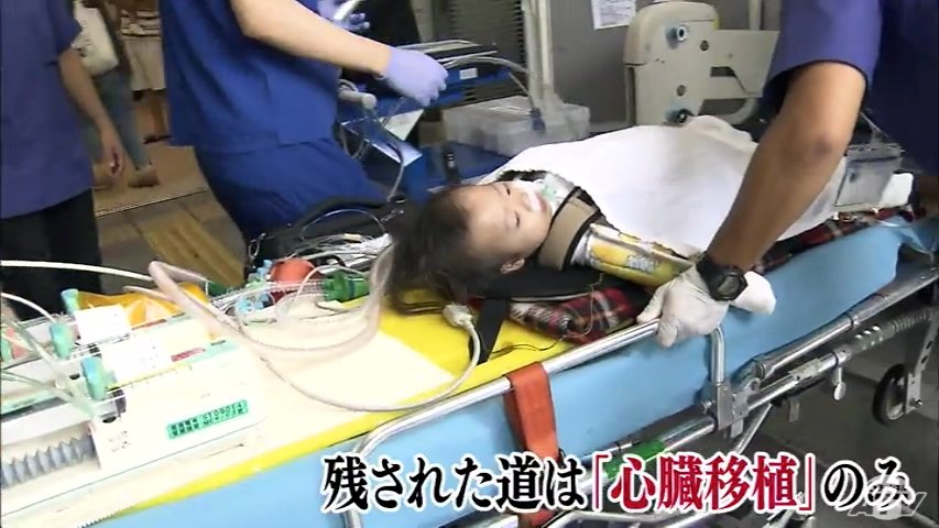 臓器移植法とは – 臓器移植法 改正 わかりやすい – PJCJZY