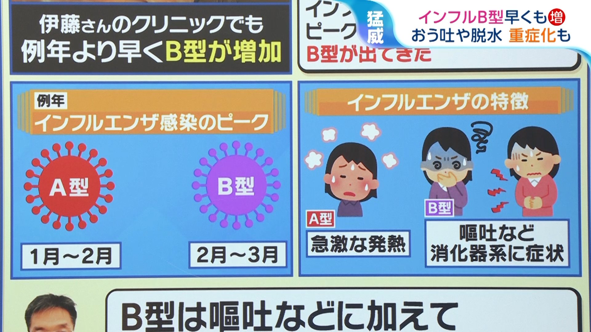 インフルエンザのピーク前倒しで「B型」早くも増加傾向に おう吐など