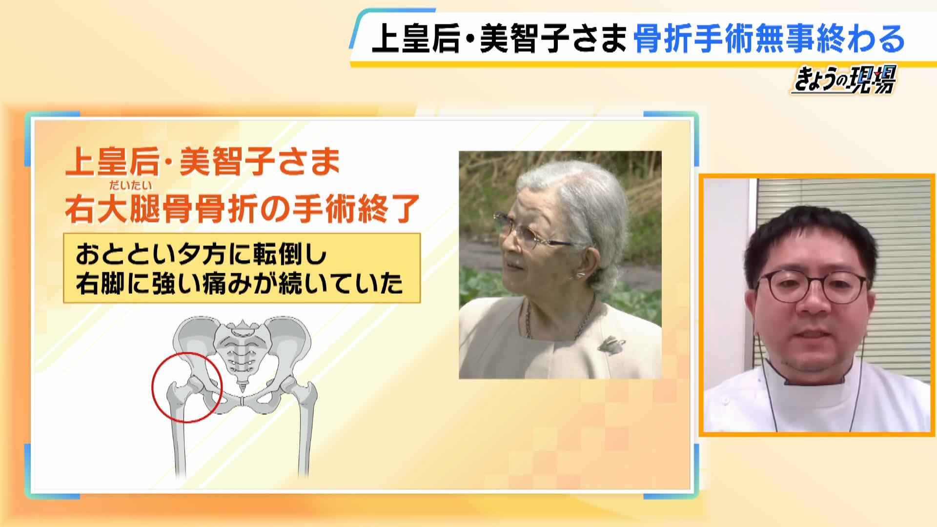 上 皇后 美智子 さま 骨折