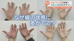 「手相が変わる」ってホント？ 運勢をみるだけじゃない！手相が示す健康状態と生活のクセ「医学」と「占い」それぞれの解釈|TBS NEWS DIG