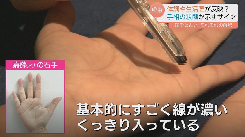 手相が変わる」ってホント？ 運勢をみるだけじゃない！手相が示す健康