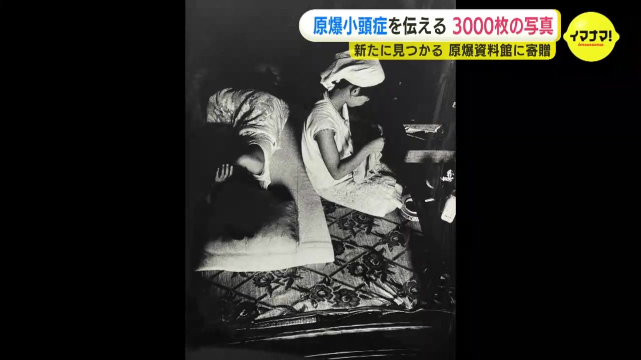 「震える手で撮影した」母親の胎内で被爆 原爆小頭症の被爆者たち 約3000枚の写真が新たに見つかる 原爆資料館に寄贈・保存活用へ TBS
