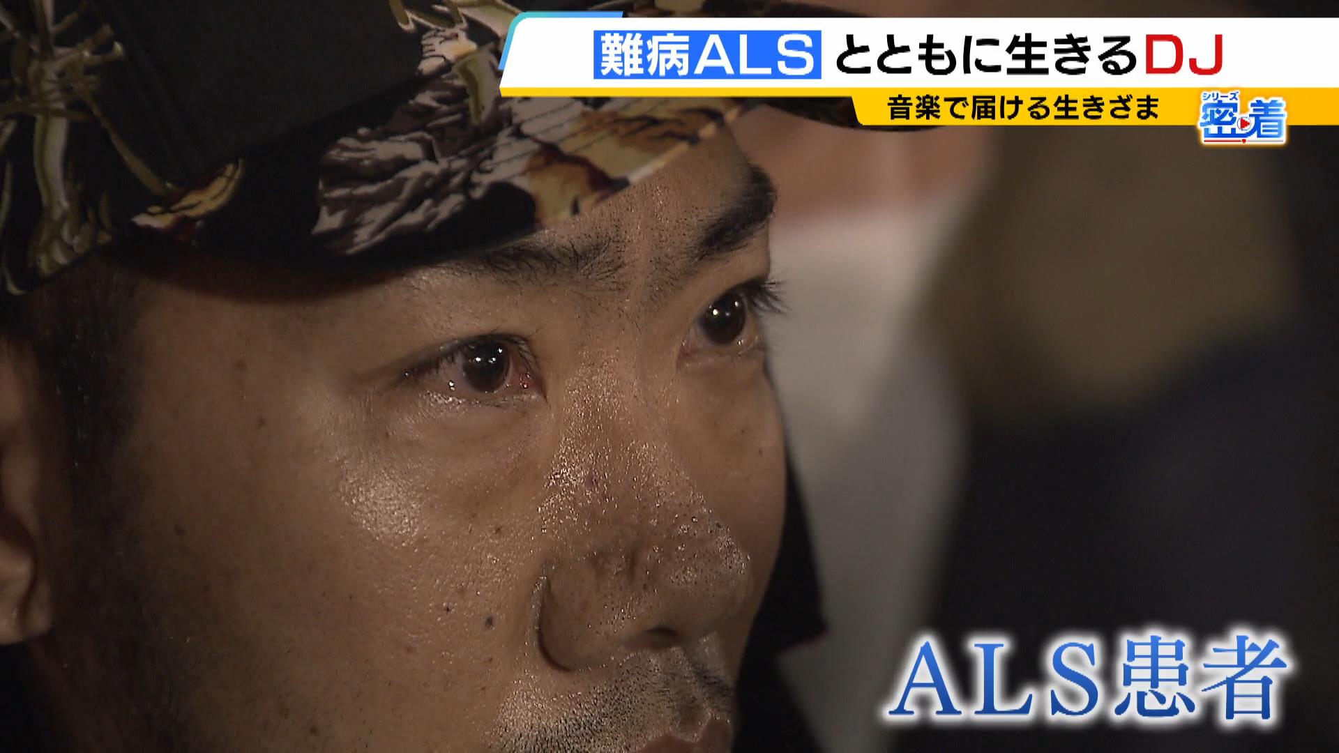 24歳で難病ALSと診断気力なくした男性を変えたのは